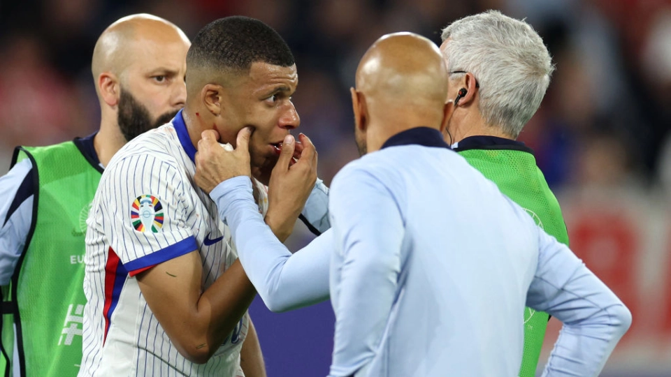 Kylian Mbappé (Francia) si infortuna al naso durante il match tra Austria e Francia a Euro 2024