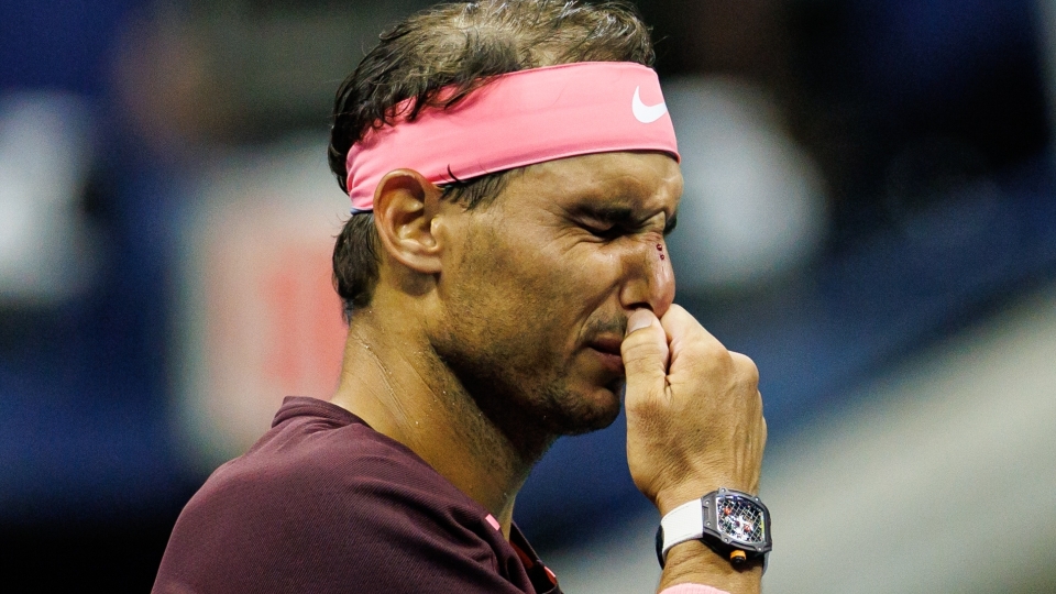 Rafael Nadal hurt his nose in the win over Fabio Fognini RafaelNadalCropped